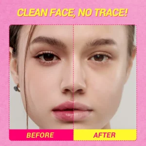 DAZZLE ME Acne Armor Remover Wipes 20's (Penanggal Mekap) - AHA-BHA Power proof cleanser & Acne-Prone Friendly - Image 3
