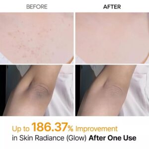 PEEL SHOT Kojic Acid Turmeric Spray 200ml - Image 4